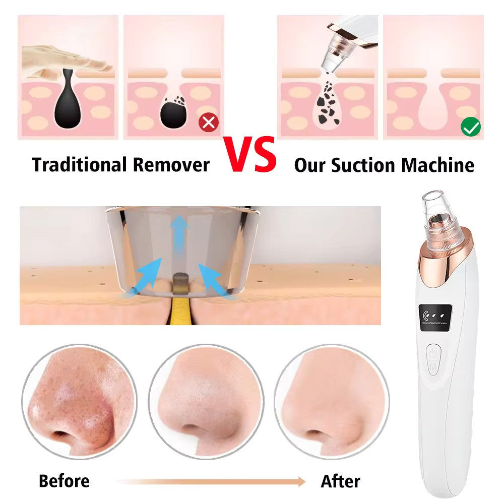 Blackhead Remover Diamond Dermabrasion Nose Vacuum Pore Cleanser Acne Pimple Suction Extractor USB Rechargeable Skin Care Tool